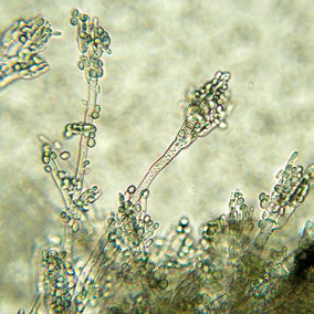 Rys. 3: Zdjęcie fotomikrograficzne grzyba Penicillium digitatum, na którym widoczne są konidiofory i spory. 